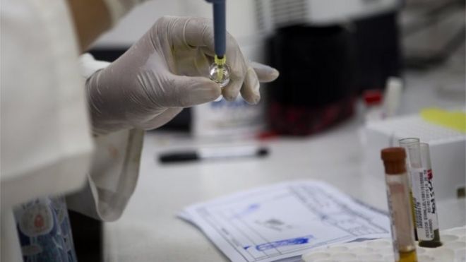 Blood samples tested for Zika virus in Guatemala (file photo)