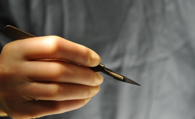 Image of a scalpel