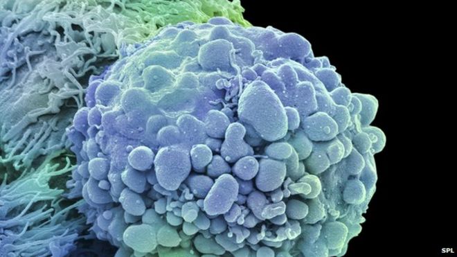 'Softener' may help kill cancers 