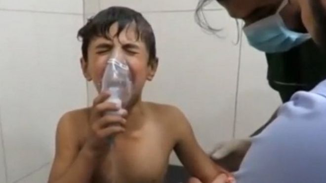 Un niño respira con una máscara de oxígeno en una clínica en Siria
