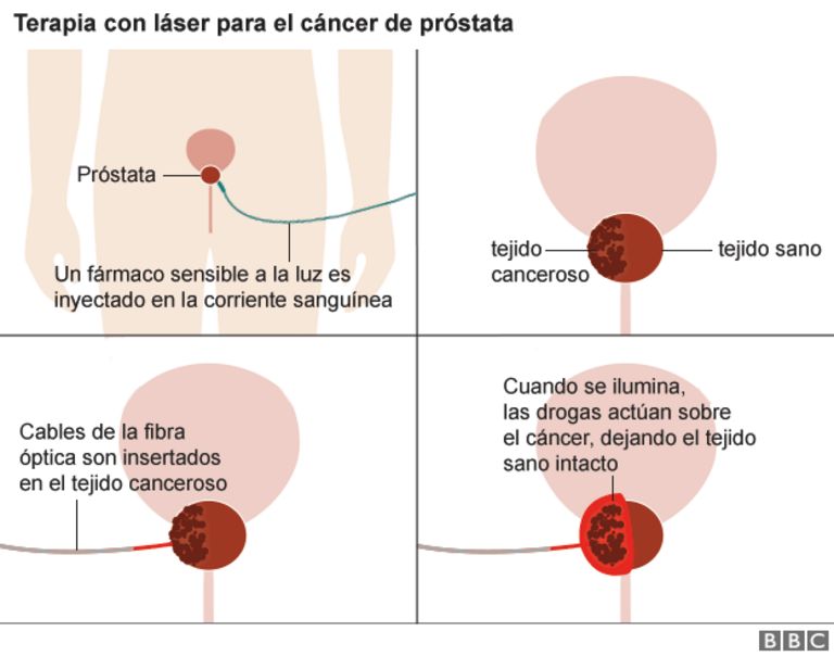 Gráfico