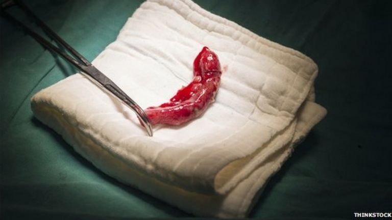Appendix