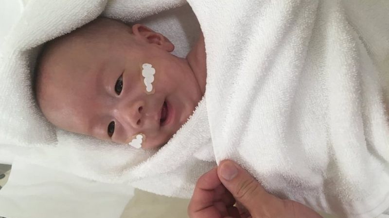 World S Smallest Surviving Premature Baby Released From US Hospital