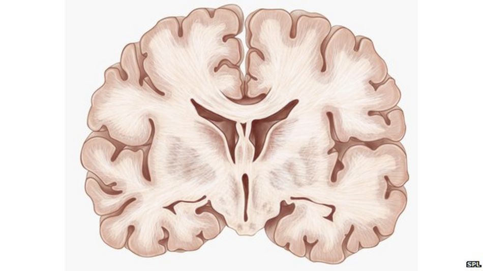 brain cross section