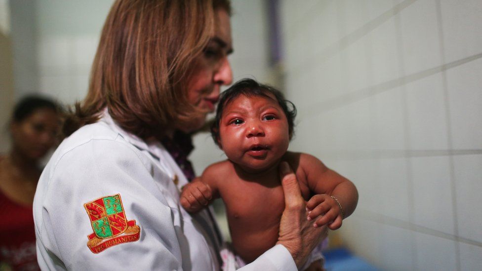 Doctora con un niño con microcefalia.