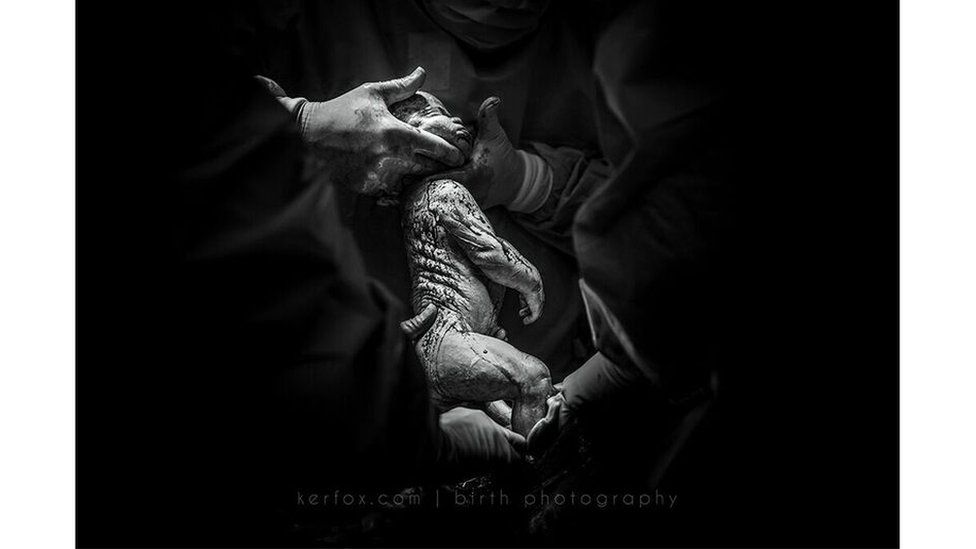 Mención especial: "17 años esperando: un milagro de "no-fertilidad", de Ker-Fox Photography