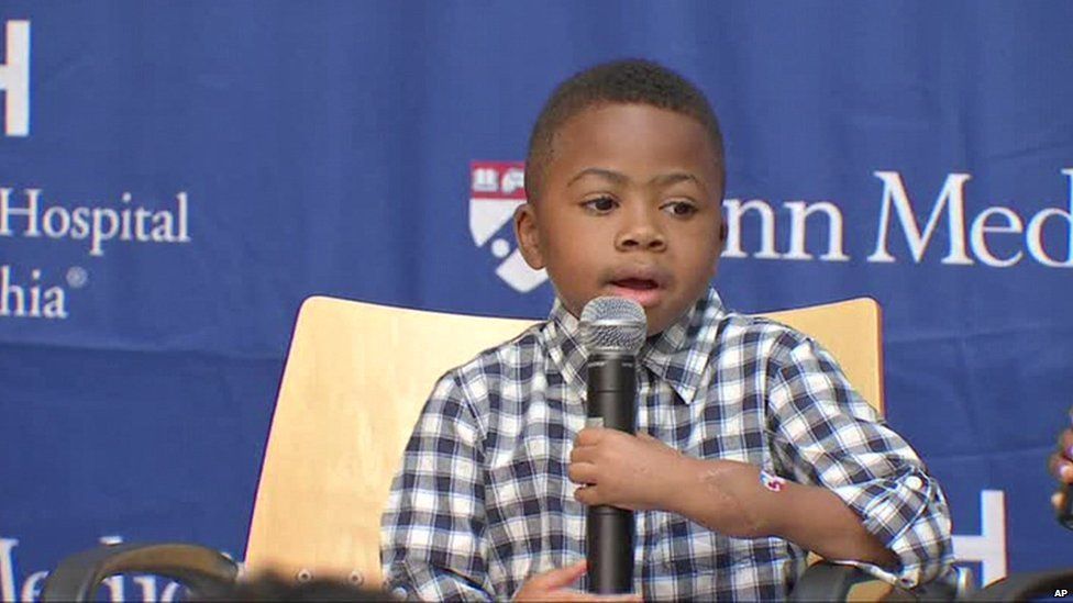 Zion Harvey shows off his hands, a year since his double transplant.