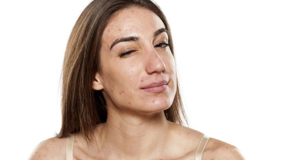 how-to-get-rid-of-acne-using-forever-nutritional-supplements-health