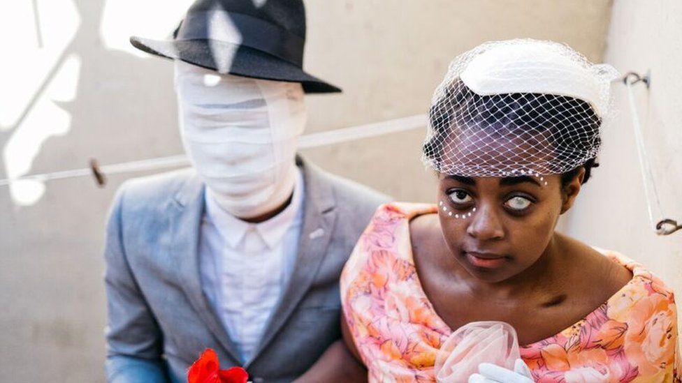 A photograph by TSoku Maela showing a man with a bandaged face and a women with a glazed eye - both smartly dressed