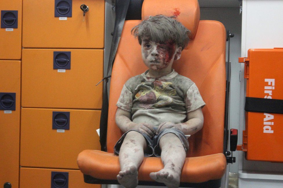 Omran Daqneesh mvulana wa Syrian aliyejaa vumbi na damu akiwa amekaa ndaniya gari la kubebea wagonjwa aliokolewa kutoka kwenye vifusi vya jengo lililopigwa na makombra ya anga katika mji wa ngome ya waasi wa Syria wa Qaterji tarehe 17 Agosti 2016.