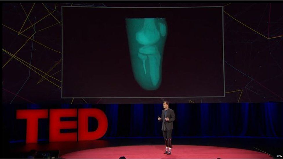 Hugh Herr's TED Talk