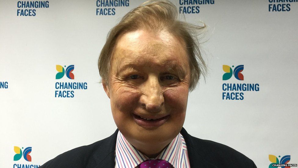 James Partridge of Changing Faces