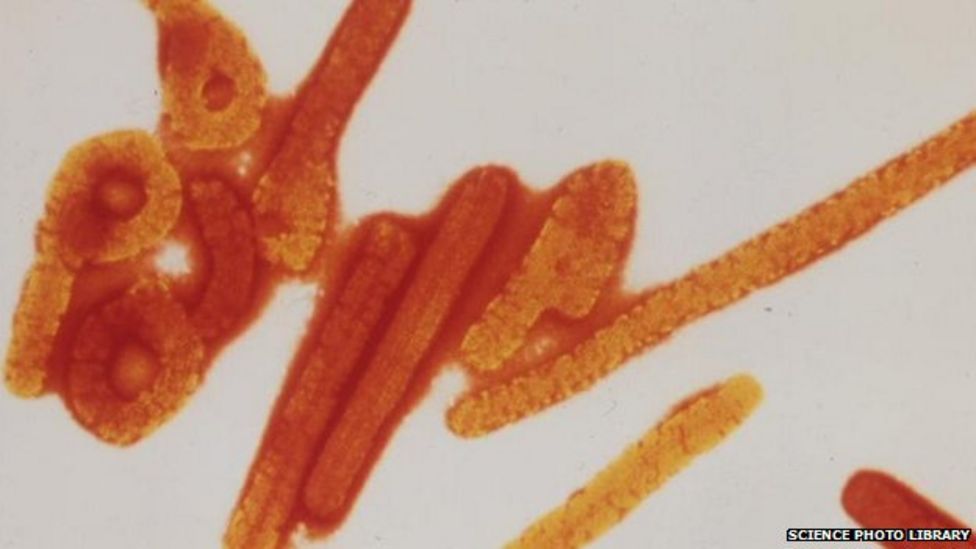 Coloured transmission electron micrograph (TEM) of a number of Ebola viruses