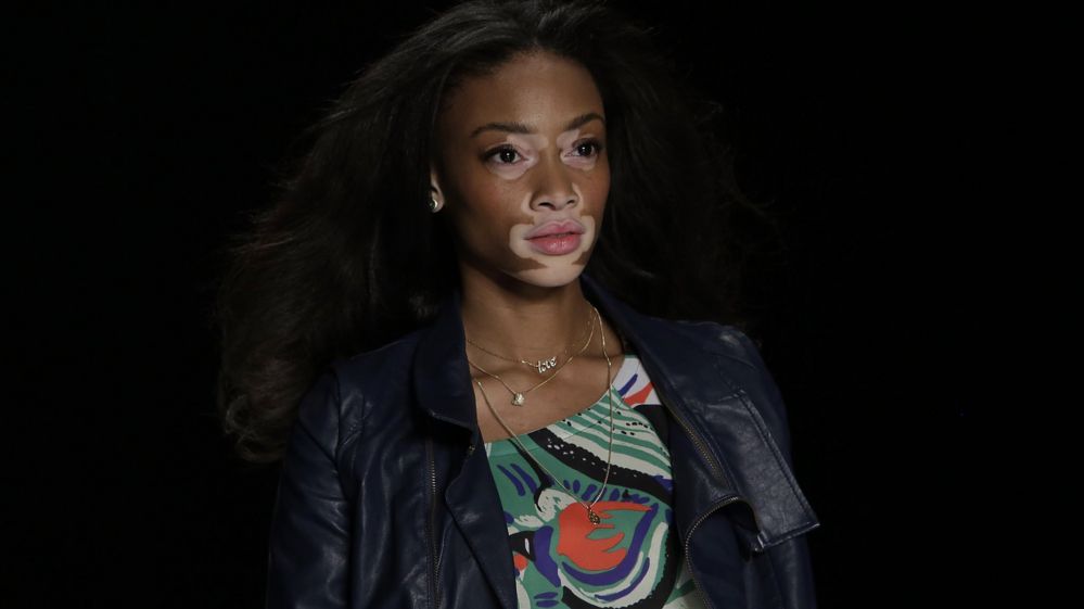 Winnie Harlow