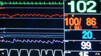 monitor cardiaco