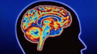 cerebro