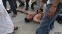 Un manifestant blessé au cours d'affrontements entre partisans de Morsi et les forces de sécurité à Nasr City, banlieue du Caire.