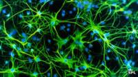Neuronas