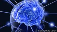 Cerebro