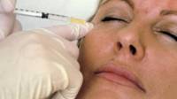 Inyección de Botox