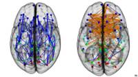 Conexiones cerebrales de hombres y mujeres