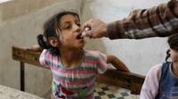 Ativista aplica vacina contra pólio em criança de Aleppo, na Síria (Reuters)