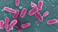 Bacterias