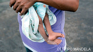 Niño desnutrido (foto: Centro Mandela)
