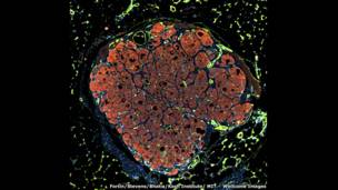 Инженерия человеческой печени, Челси Фортин, Келли Стивенс и Санджита Батиа, институт Роберта Коха