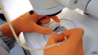 stem cells