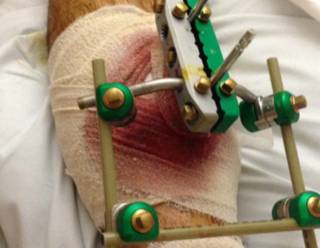 151002121100_pierna_quebrada__624x485_ma