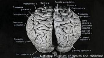 Cerebro de Einstein