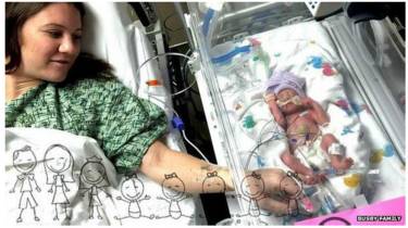 bayi kembar lima texas
