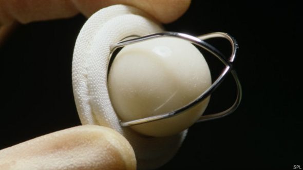 Válvula artifical de corazón (foto de archivo)