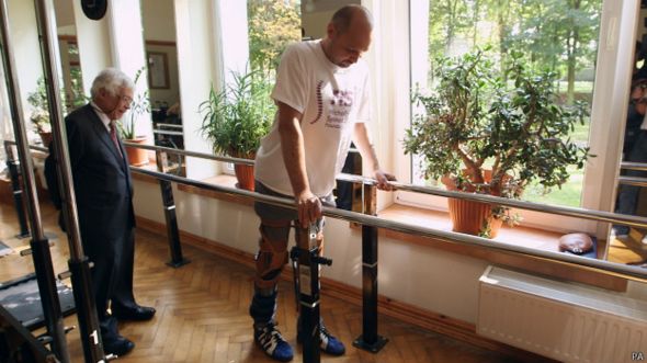 Darek Fidyka sufría de parálisis y vuelve a caminar después de una terapia pionera de trasplante de células