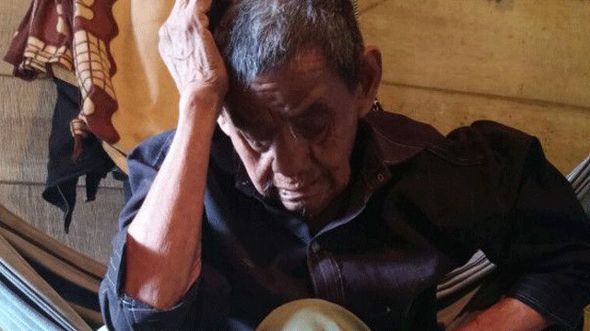 Guatemala, sífilis, EE.UU., demada, víctimas