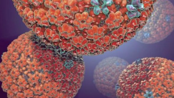Virus.