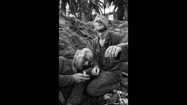 El médico de la División de la Primera Caballería Thomas Cole, con un ojo vendado, trata al sargento Harrison Pell. Fue tomada el 30 de enero de 1966 durante un intercambio de disparos en An Thi entre tropas estadounidenses y fuerzas combinadas del Viet Cong y Vietnam del Norte. Foto de Henri Huet/AP