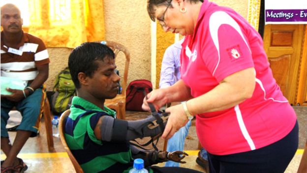 150612173744_jaffna_artificial_arms_640x