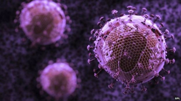Virus de inmunodeficiencia adquirida