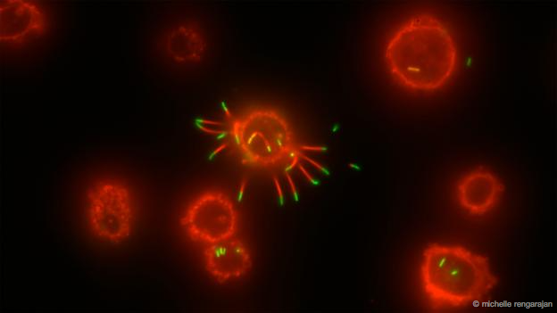 Listeria monocytogenes (Foto: Michelle Rengarajan)