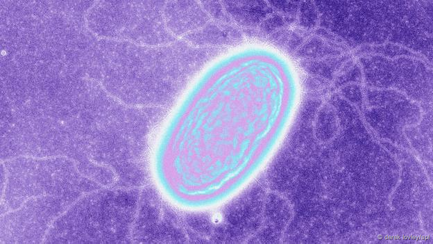 Caulobacter crescentus (Foto: Derek Lovley/SPL)