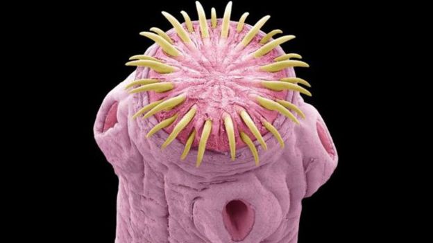 151105144025_tapeworm_640x360_sciencephotolibrary_nocredit.jpg