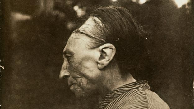 151126120635_skull_reshaping_1.jpg
