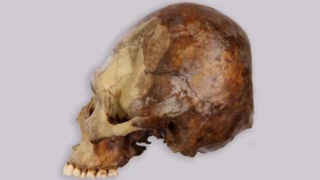 151126120635_skull_reshaping_2.jpg