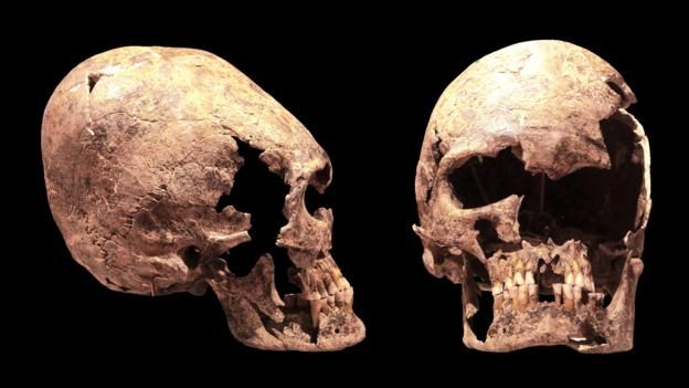 151126120636_skull_reshaping_6.jpg