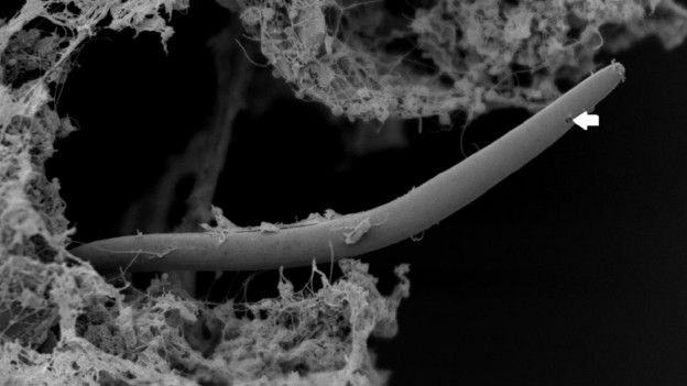 Gusano nematodo