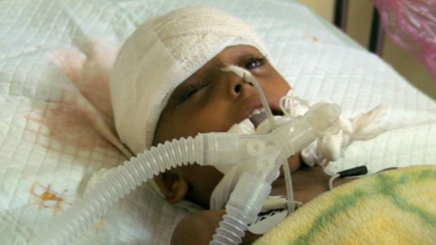 160108162900_asma_yemen_640x360_bbc_nocredit.jpg