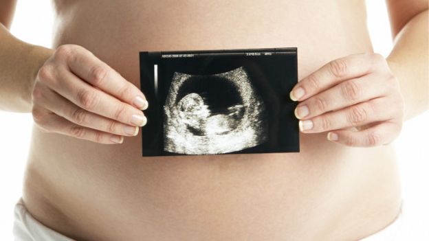 Foto: Thinkstock