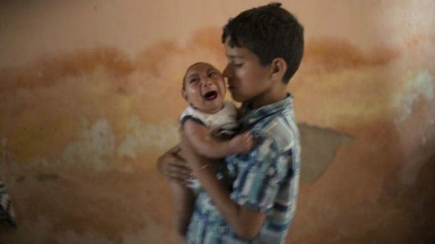 Menos sostiene a su hermano de dos meses, nacido con microencefalia.